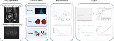 MRI Radiomic Features: A Potential Biomarker for Progression-Free Survival Prediction of Patients With Locally Advanced Cervical Cancer Undergoing Surgery